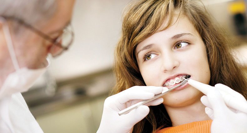 THE ULTIMATE ORTHODONTIC RETAINER GUIDE