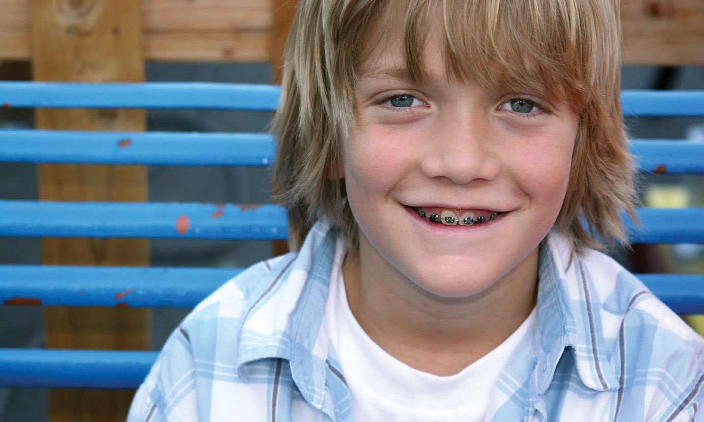 How to get your child excited about braces or Invisalign Teen?