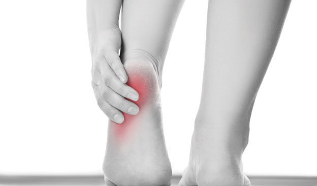 Plantar Fasciitis