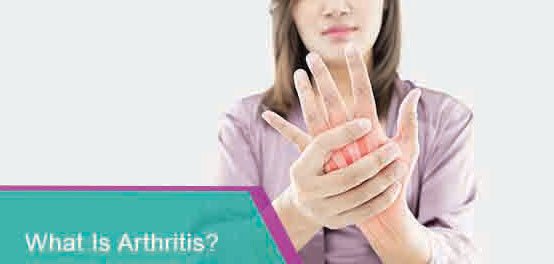 SPORTS PHYSIOTHERAPY FOR ARTHRITIS