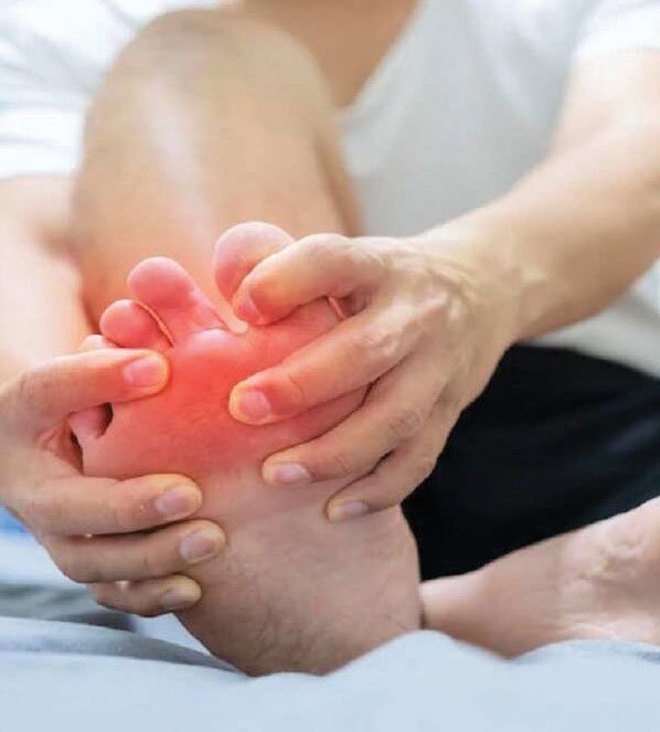 All you need to know about gout