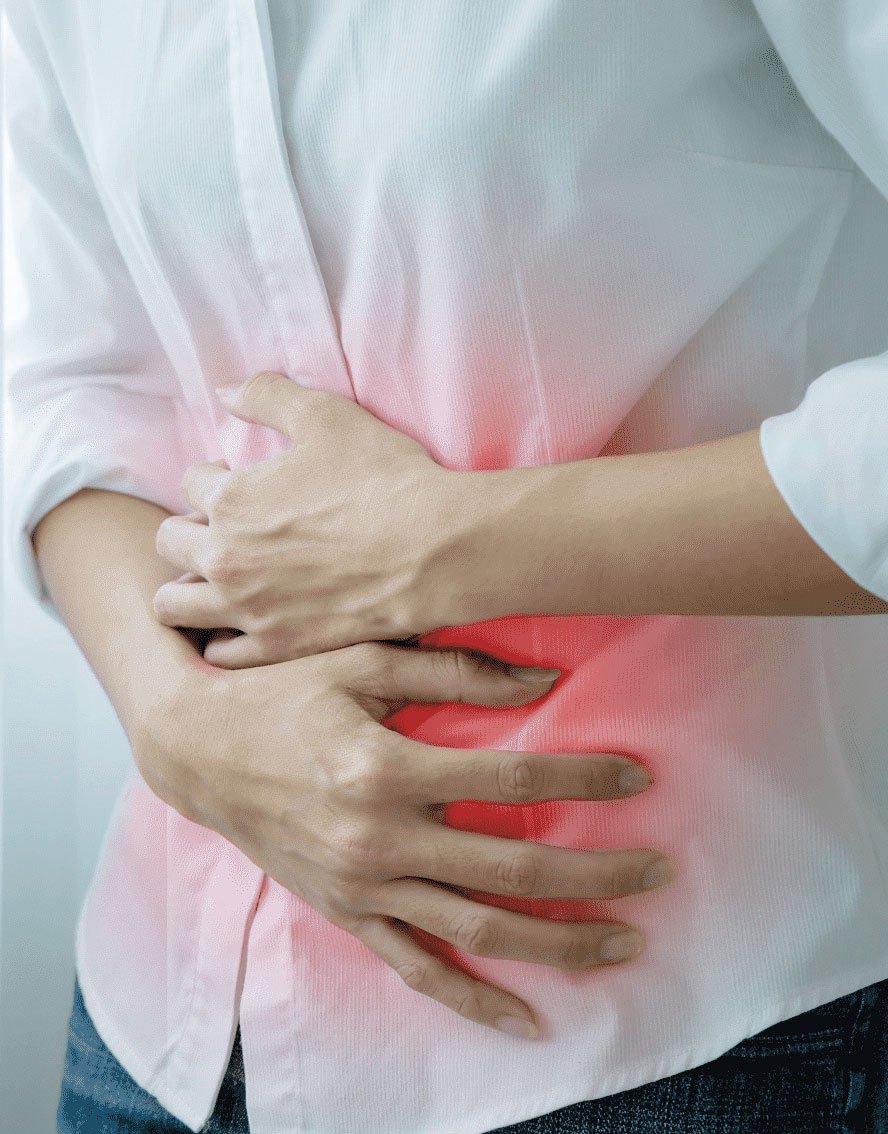 All you need to know about irritable bowel syndrome